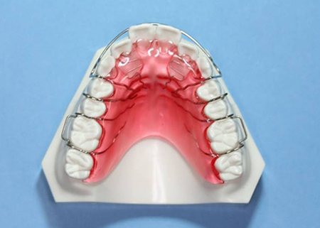 床矯正装置（アクティブプレート）