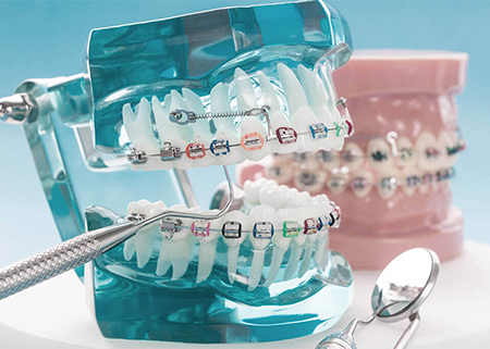 歯科矯正用アンカースクリュー